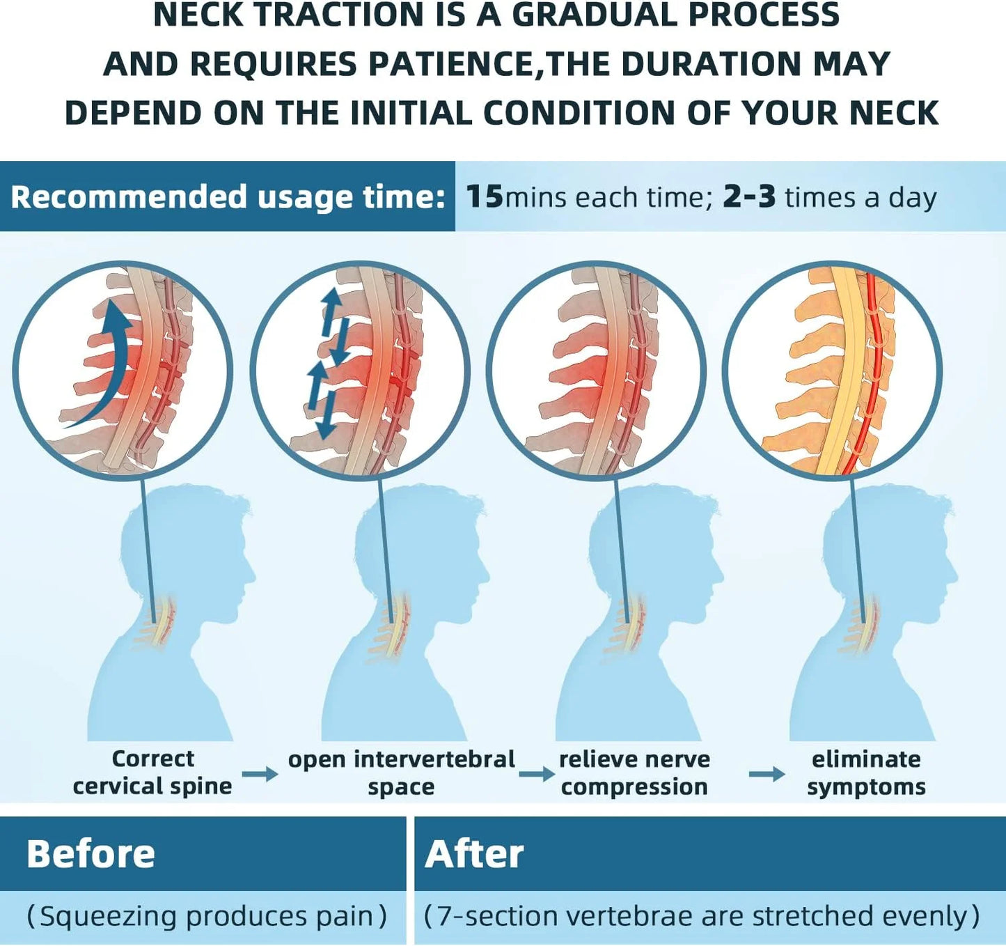 Theralimb Neck Stretcher - Theralimb