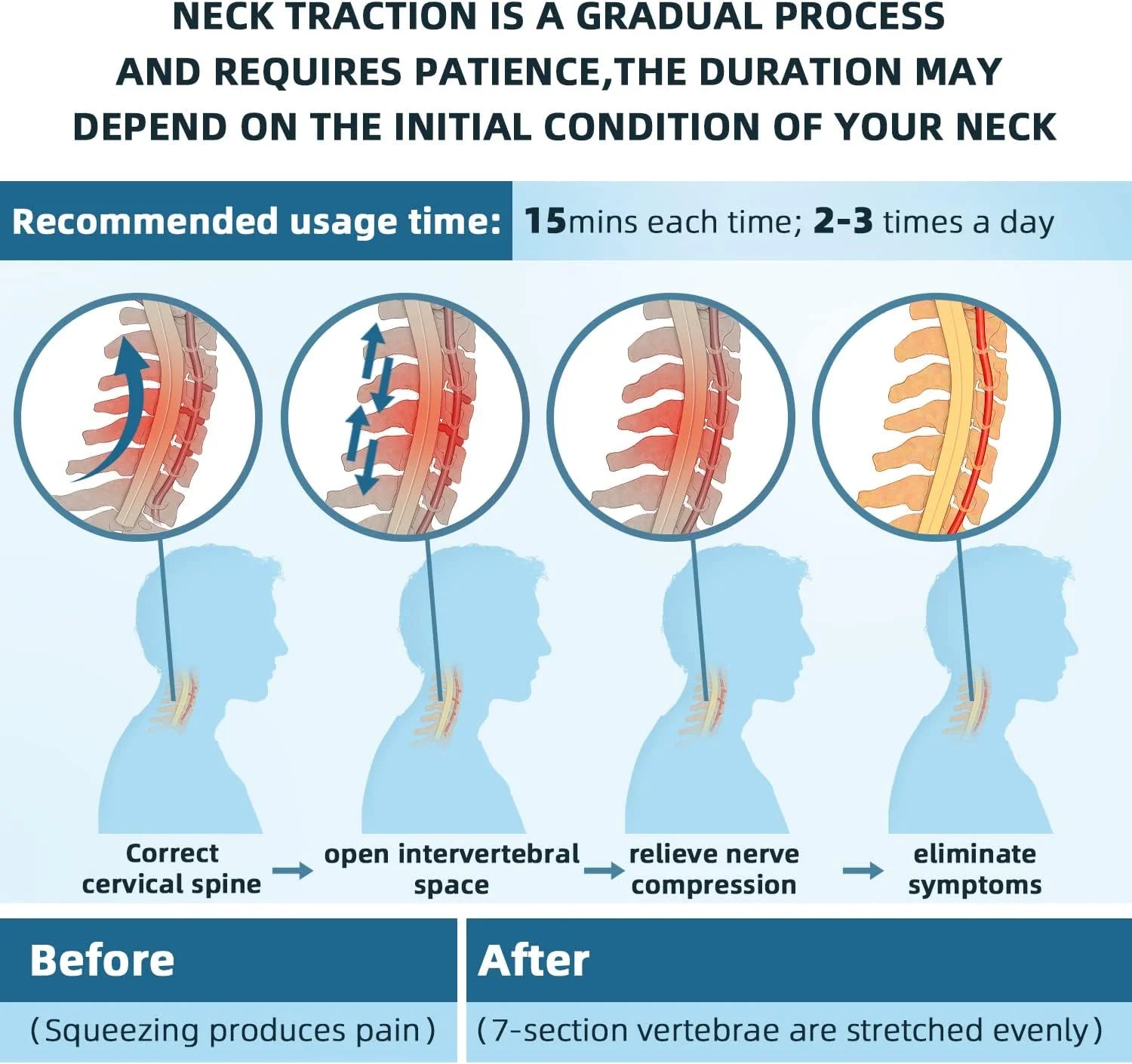 Theralimb Neck Stretcher - Theralimb