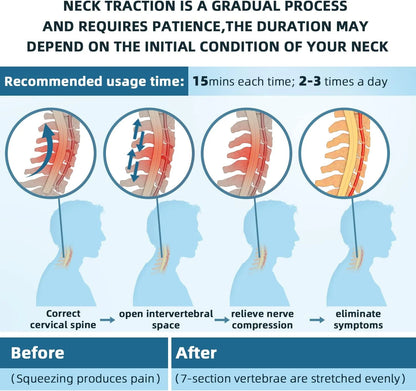 Theralimb Neck Stretcher - Theralimb